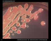 Klebsiella and salmonella on MacConkey agar